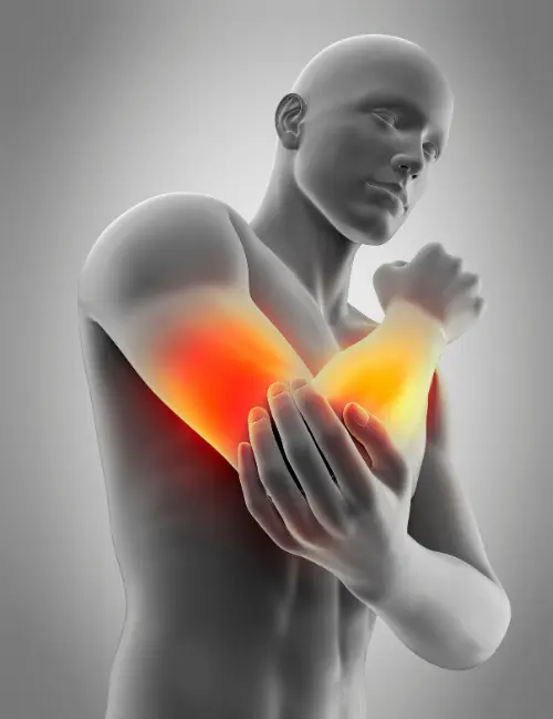 Dolor-Brazo-Y-Antebrazo Cirugía de Brazo y Antebrazo en Guadalajara