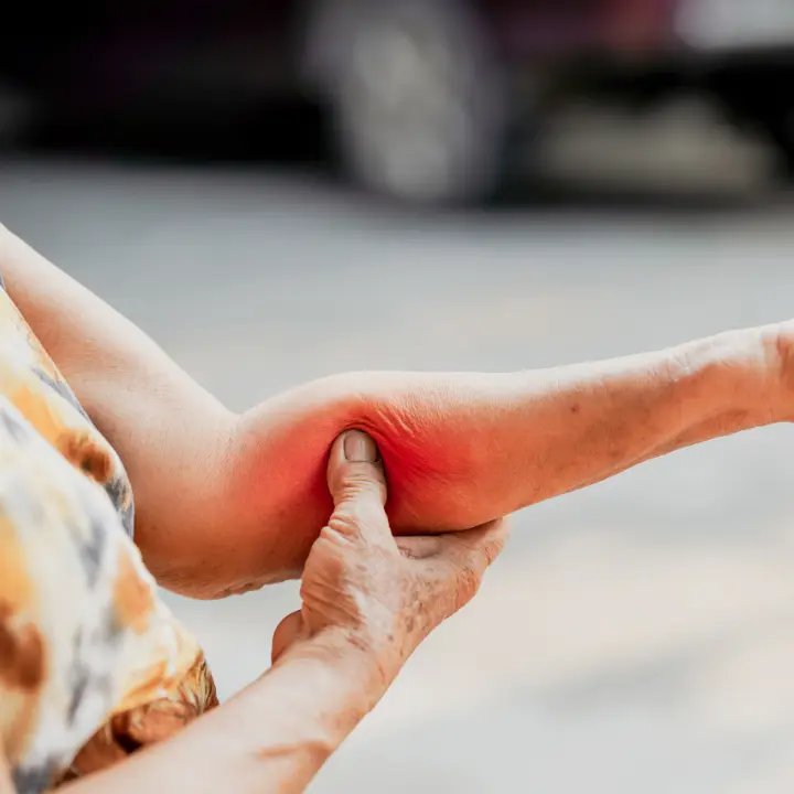Padeciiento-de-Antebrazo Cirugía de Brazo y Antebrazo en Guadalajara